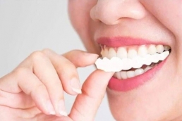 Braces 03